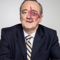 Prof Mariano Barbacid